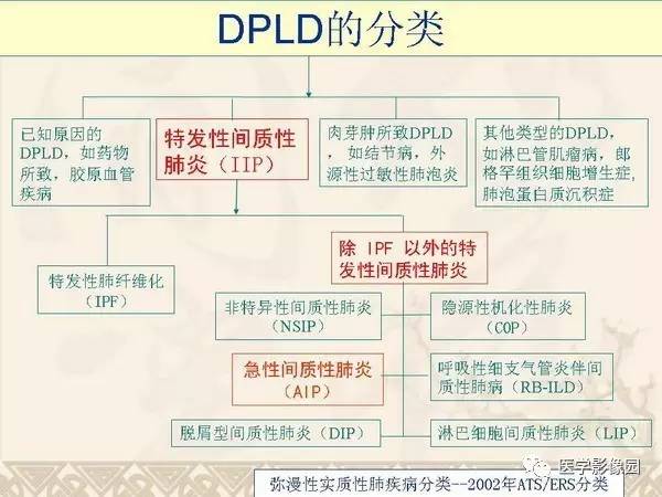 【PPT】急性间质性肺炎