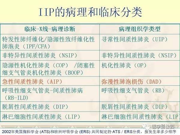 【PPT】急性间质性肺炎