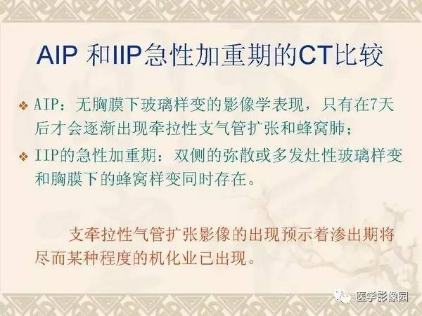 【PPT】急性间质性肺炎