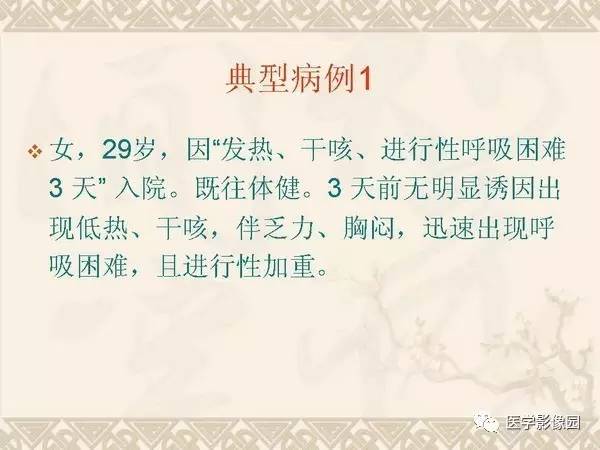 【PPT】急性间质性肺炎