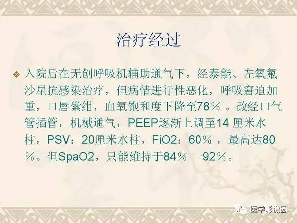 【PPT】急性间质性肺炎