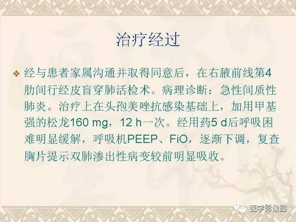 【PPT】急性间质性肺炎