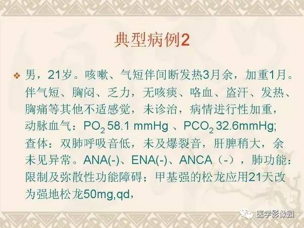 【PPT】急性间质性肺炎