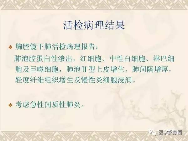【PPT】急性间质性肺炎