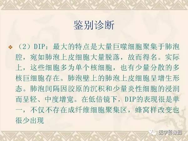 【PPT】急性间质性肺炎
