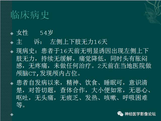 【病例】囊性(纤维型)脑膜瘤一例MR影像表现
