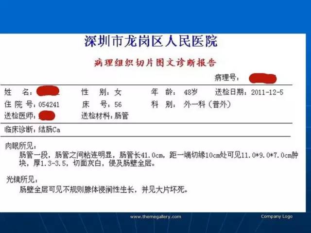 【病例】结肠高分化腺癌1例CT影像表现 【病例】结肠高分化腺癌1例CT影像表现