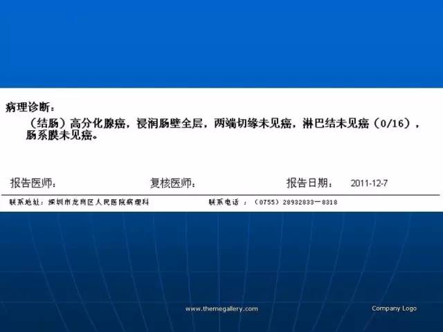 【病例】结肠高分化腺癌1例CT影像表现 【病例】结肠高分化腺癌1例CT影像表现