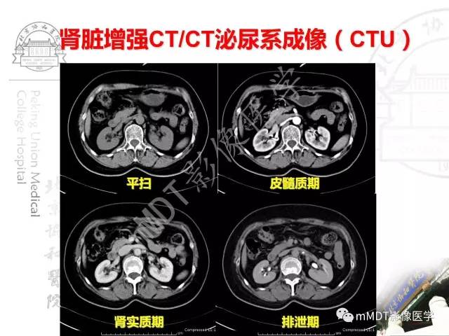 【PPT】肾实质常见肿瘤性病变的影像学诊断