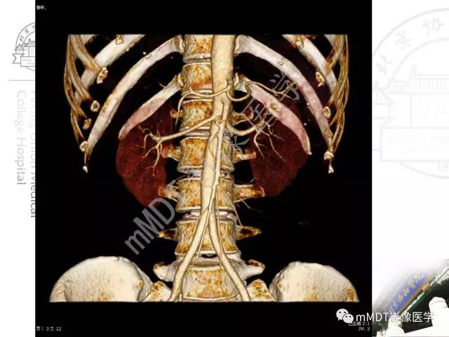 【PPT】肾实质常见肿瘤性病变的影像学诊断