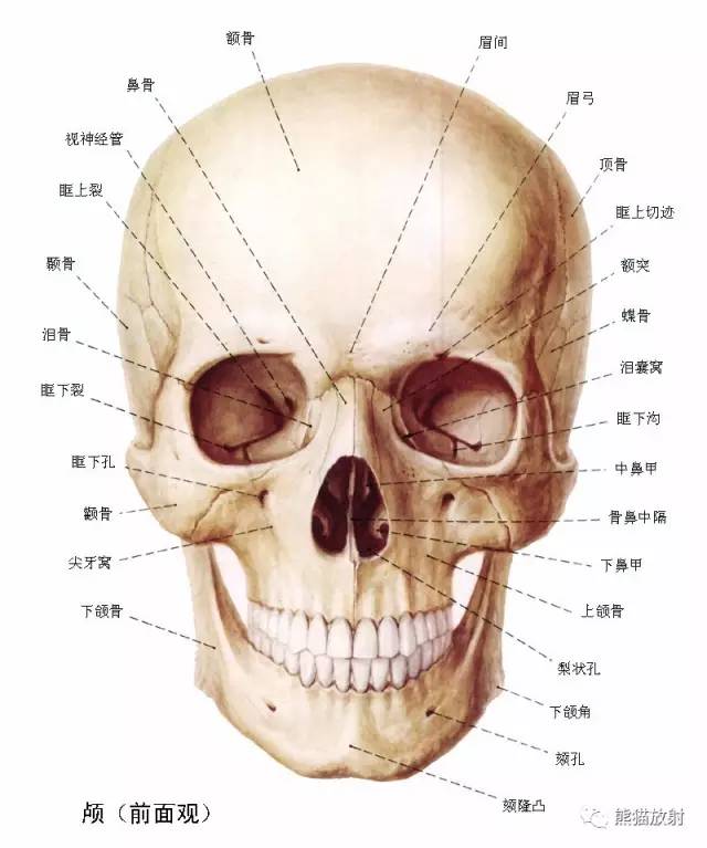 面部冠状CT断层及骨骼间隙(双语) 面部冠状CT断层及骨骼间隙(双语)