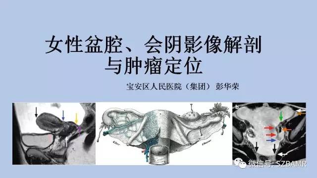 【PPT】女性盆腔、会阴影像解剖与肿瘤定位