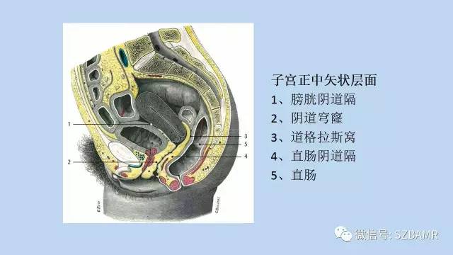 【PPT】女性盆腔、会阴影像解剖与肿瘤定位