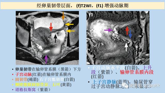 【PPT】女性盆腔、会阴影像解剖与肿瘤定位