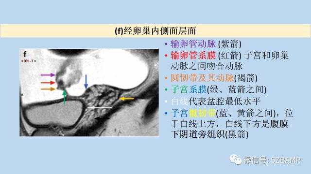 【PPT】女性盆腔、会阴影像解剖与肿瘤定位