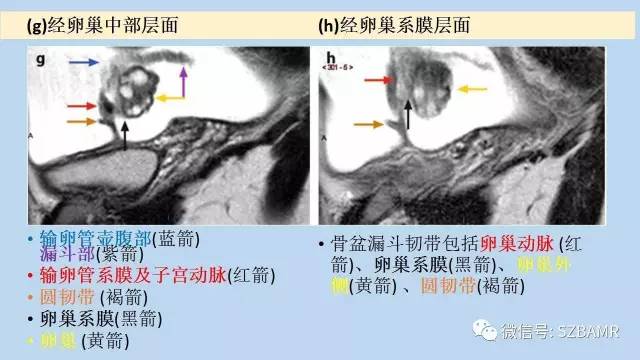 【PPT】女性盆腔、会阴影像解剖与肿瘤定位