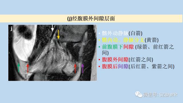 【PPT】女性盆腔、会阴影像解剖与肿瘤定位