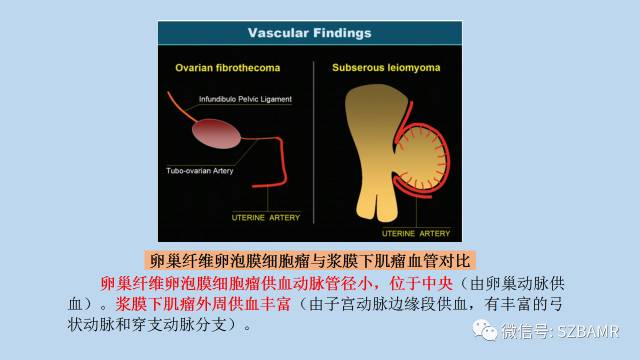 【PPT】女性盆腔、会阴影像解剖与肿瘤定位