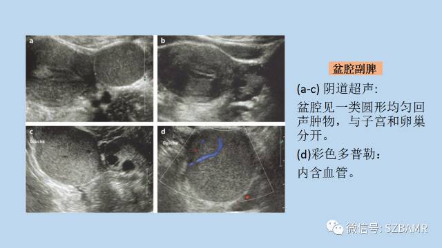 【PPT】女性盆腔、会阴影像解剖与肿瘤定位