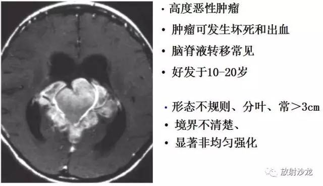 【病例】松果体区胶质瘤1例MR影像表现 【病例】松果体区胶质瘤1例MR影像表现