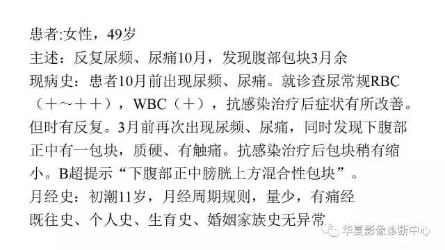 【病例】脐尿管囊肿伴感染1例CT影像表现