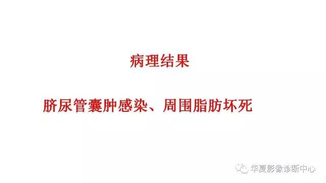 【病例】脐尿管囊肿伴感染1例CT影像表现