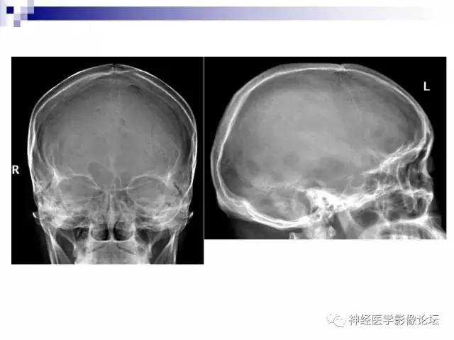 【病例】