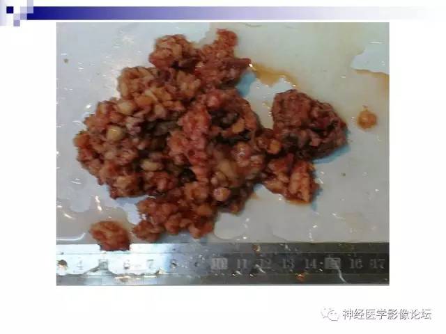 【病例】
