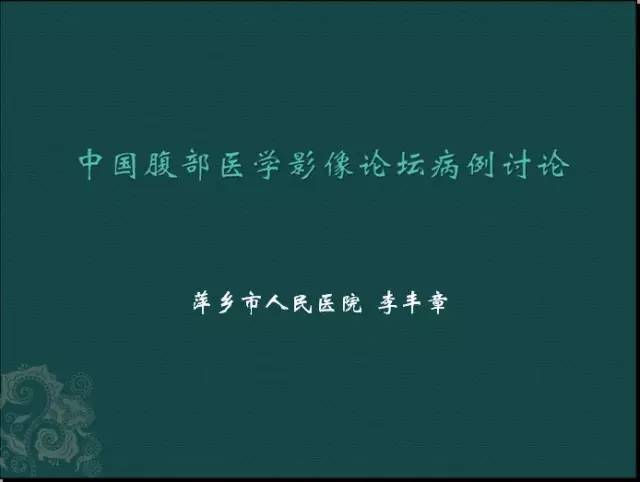 【病例】腹膜后神经鞘瘤1例CT及MR影像表现 【病例】腹膜后神经鞘瘤1例CT及MR影像表现