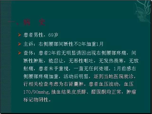 【病例】腹膜后神经鞘瘤1例CT及MR影像表现 【病例】腹膜后神经鞘瘤1例CT及MR影像表现
