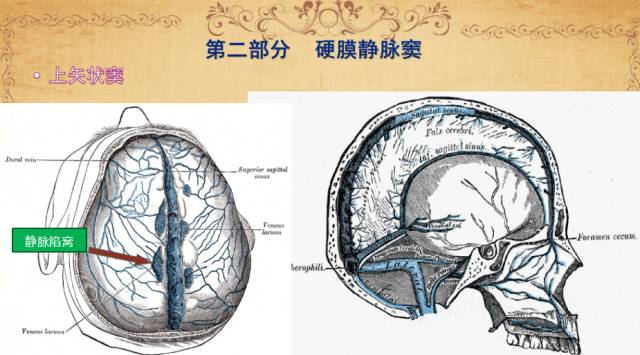 【PPT】脑静脉系统解剖