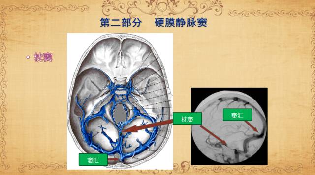 【PPT】脑静脉系统解剖