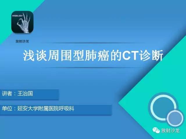 【PPT】浅谈周围型肺癌的CT诊断