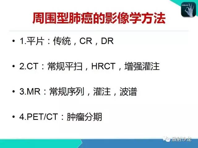 【PPT】浅谈周围型肺癌的CT诊断