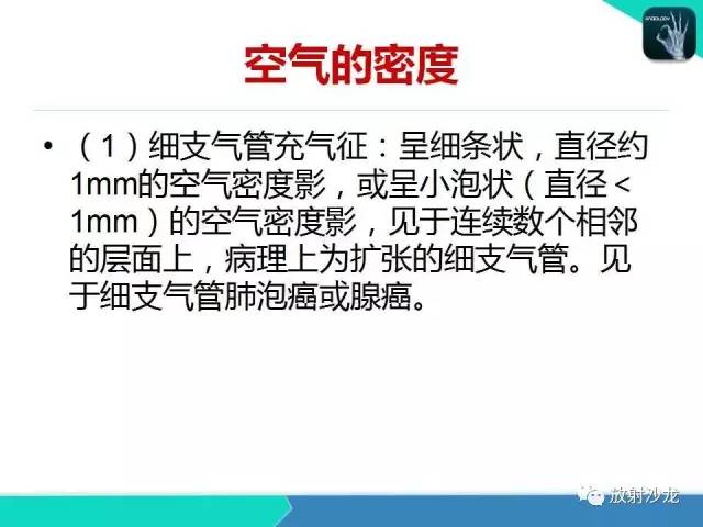 【PPT】浅谈周围型肺癌的CT诊断