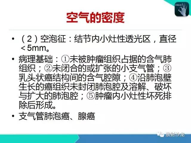 【PPT】浅谈周围型肺癌的CT诊断