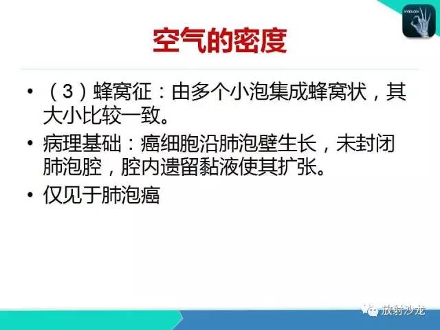 【PPT】浅谈周围型肺癌的CT诊断