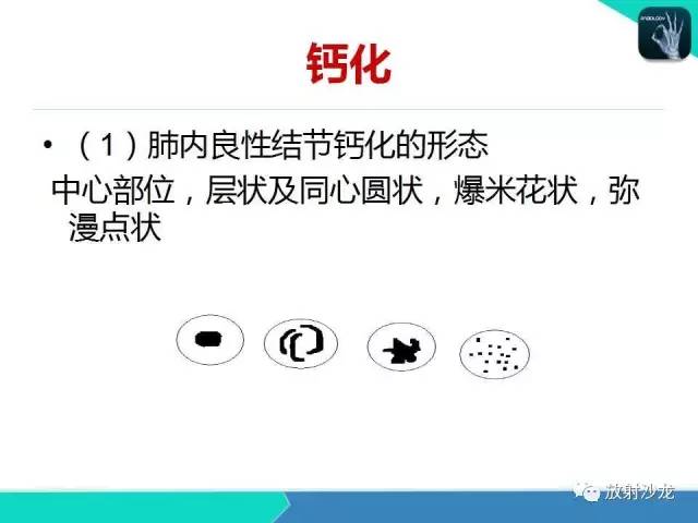 【PPT】浅谈周围型肺癌的CT诊断