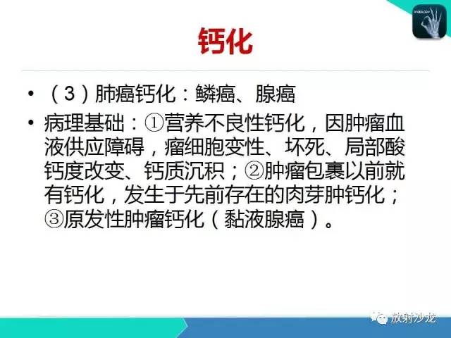 【PPT】浅谈周围型肺癌的CT诊断