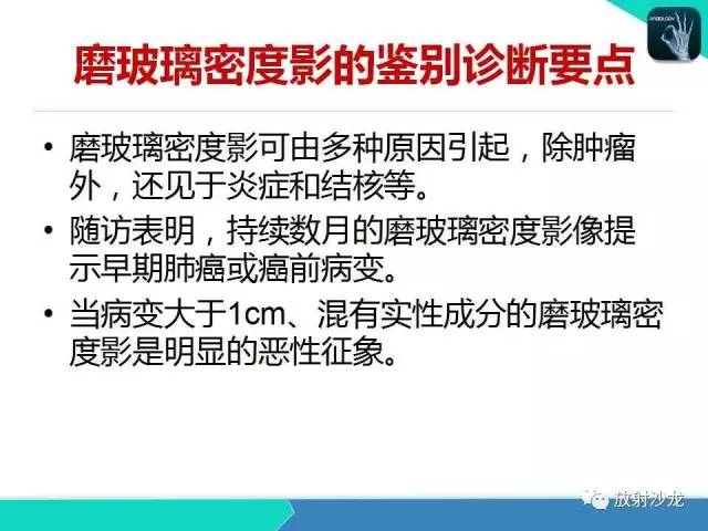 【PPT】浅谈周围型肺癌的CT诊断