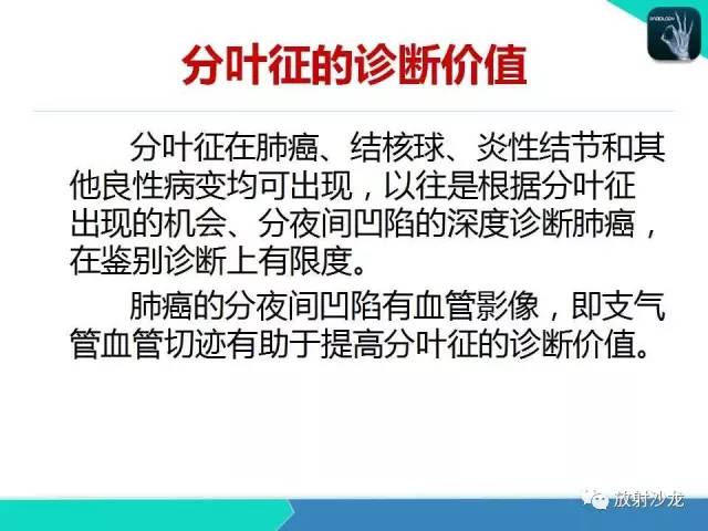 【PPT】浅谈周围型肺癌的CT诊断