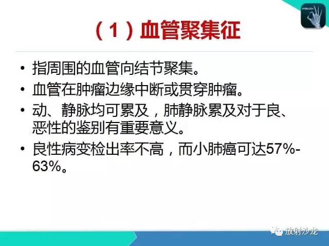 【PPT】浅谈周围型肺癌的CT诊断
