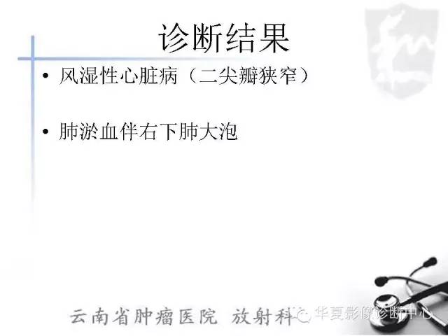 【PPT】X线如何区分肺水肿和肺淤血
