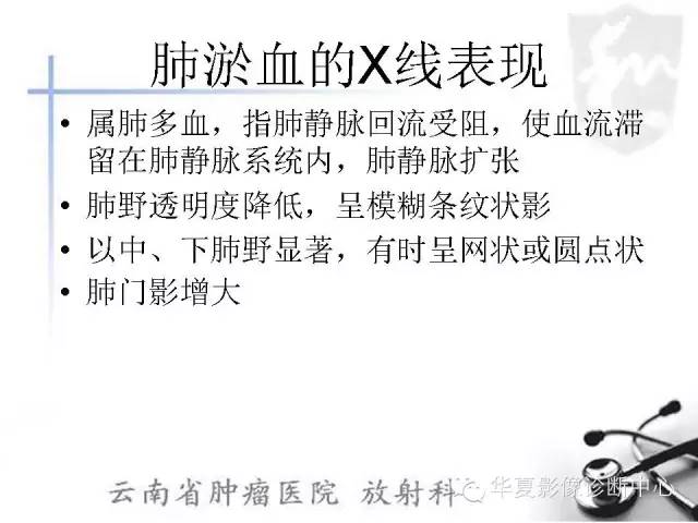 【PPT】X线如何区分肺水肿和肺淤血