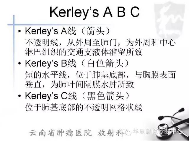 【PPT】X线如何区分肺水肿和肺淤血