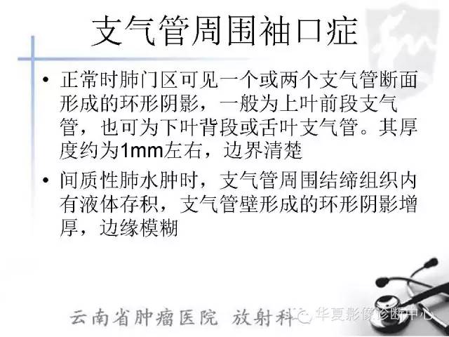 【PPT】X线如何区分肺水肿和肺淤血