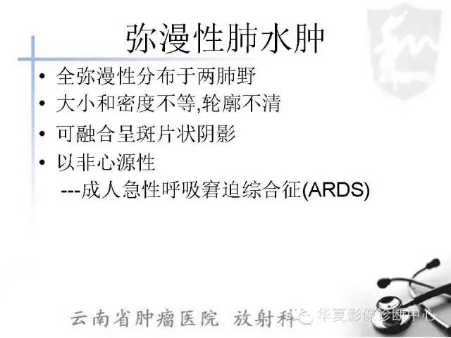 【PPT】X线如何区分肺水肿和肺淤血