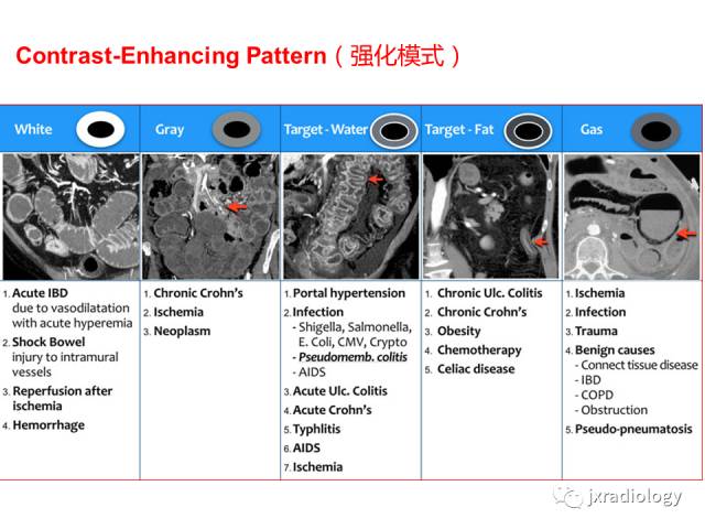【PPT】肠壁增厚的CT鉴别诊断