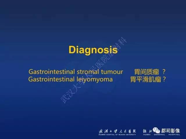 【PPT】胃神经鞘瘤影像诊断