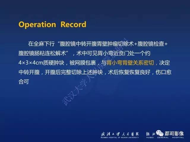 【PPT】胃神经鞘瘤影像诊断